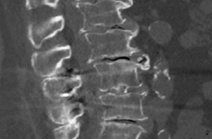 Surgical Treatment Image 1