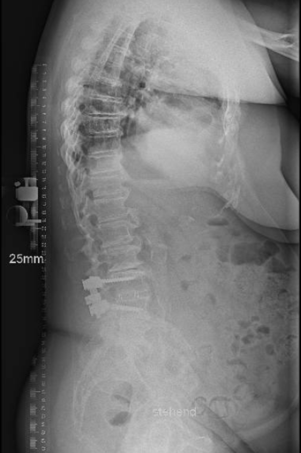 Pre-Op Image 1