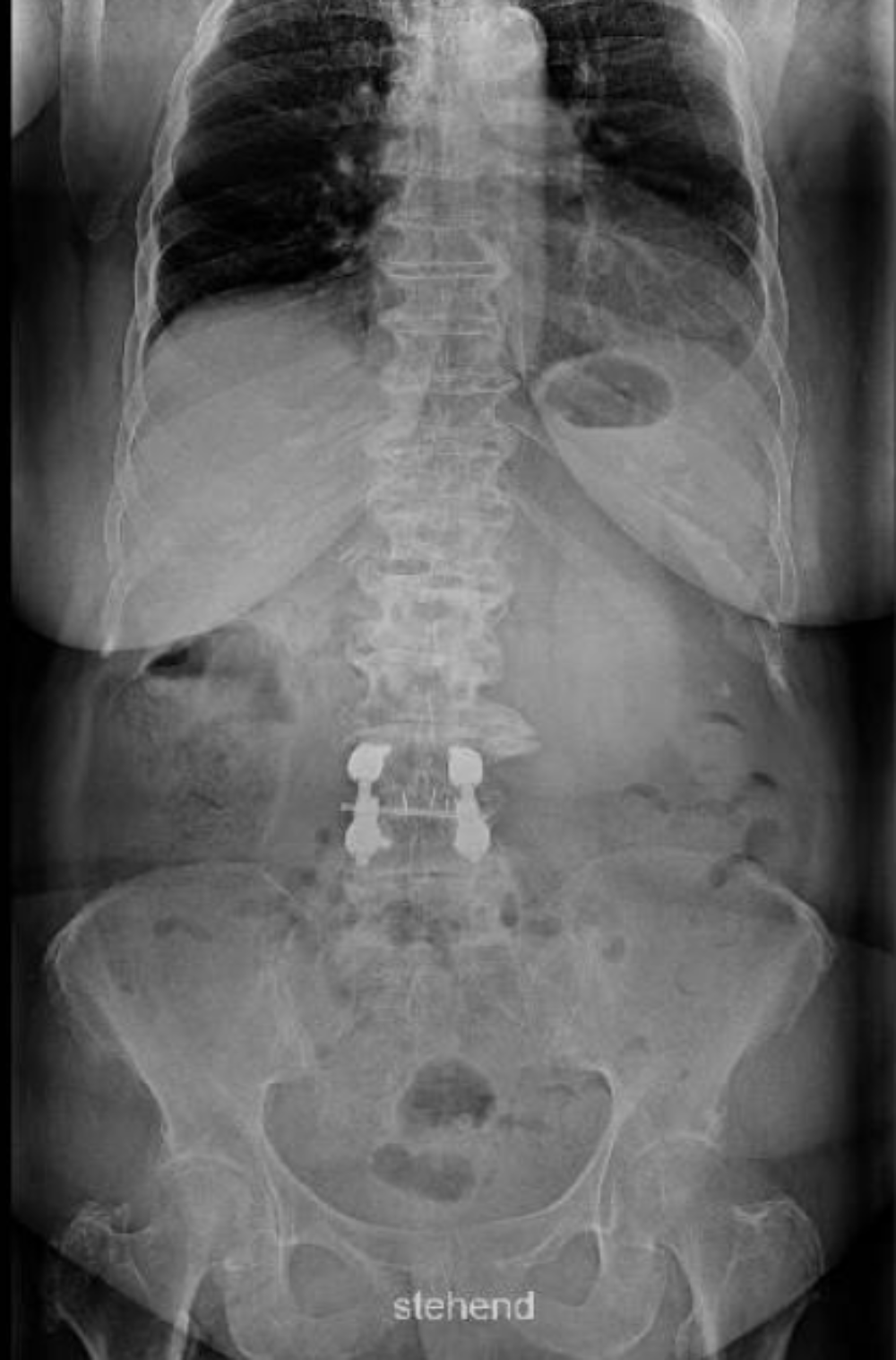 Pre-Op Image 2