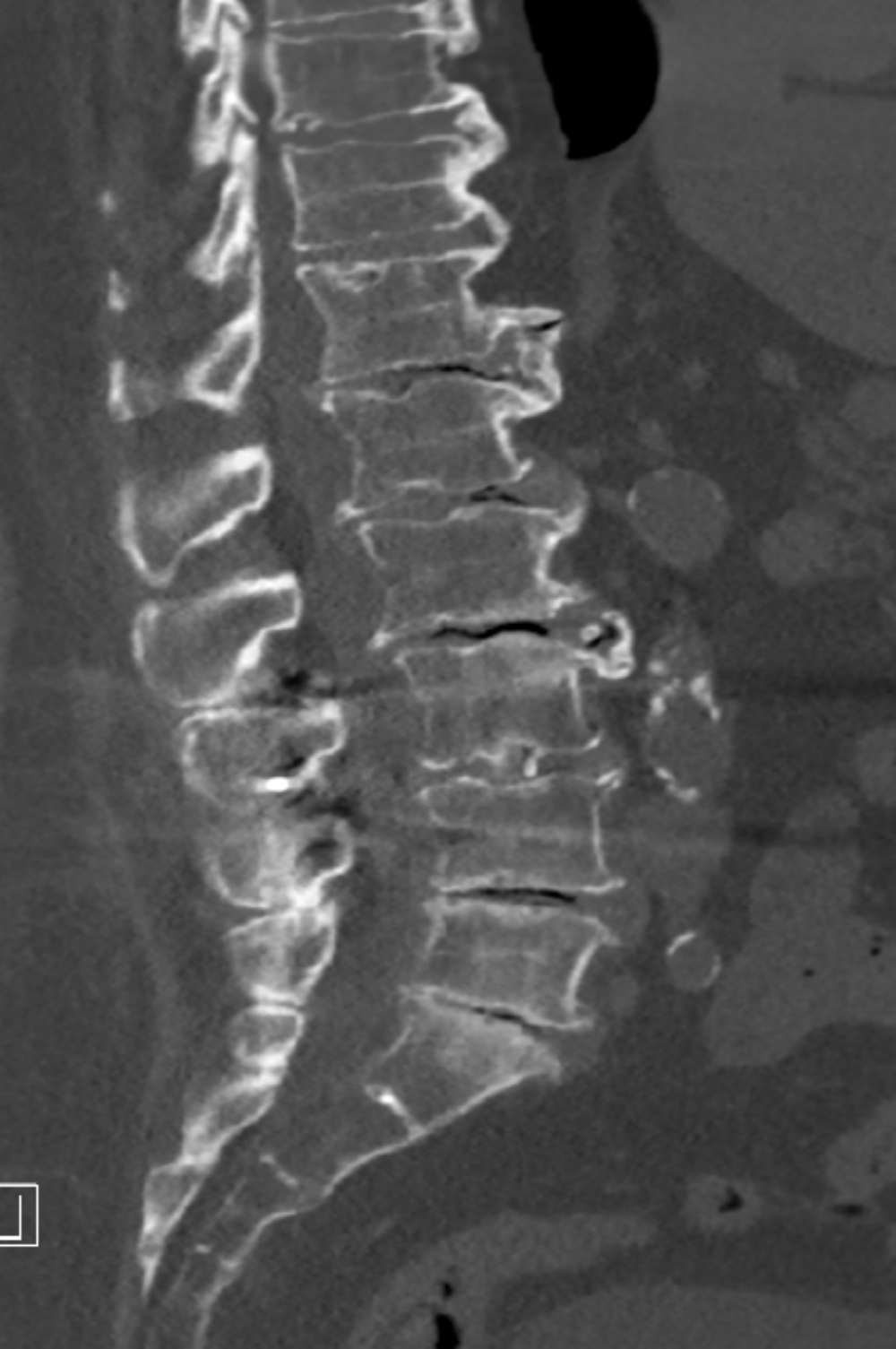 Surgical Treatment Image 1