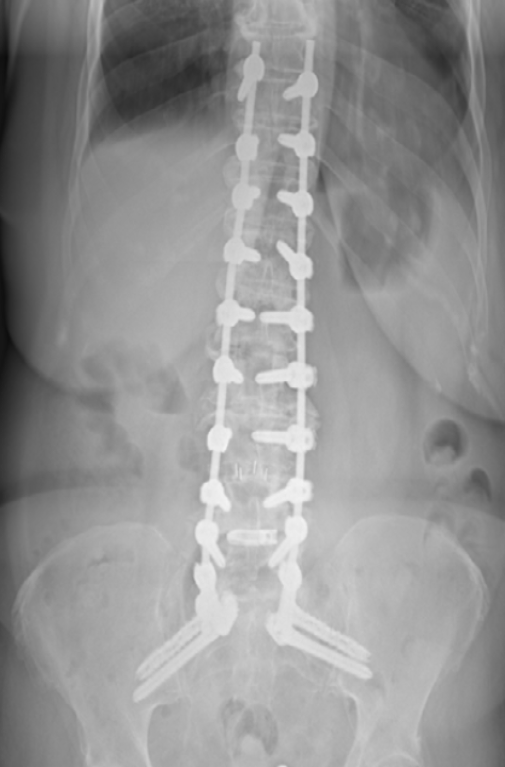Post-Op Image 2