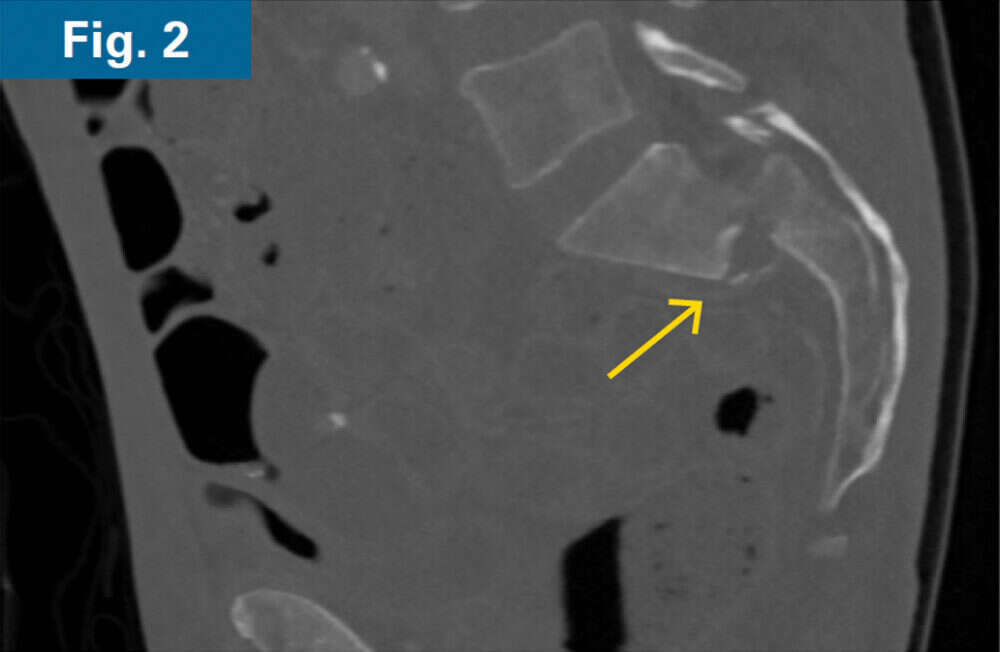 Inline firoozabadi case 2 02