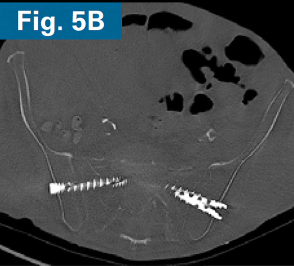 Inline firoozabadi case 2 06