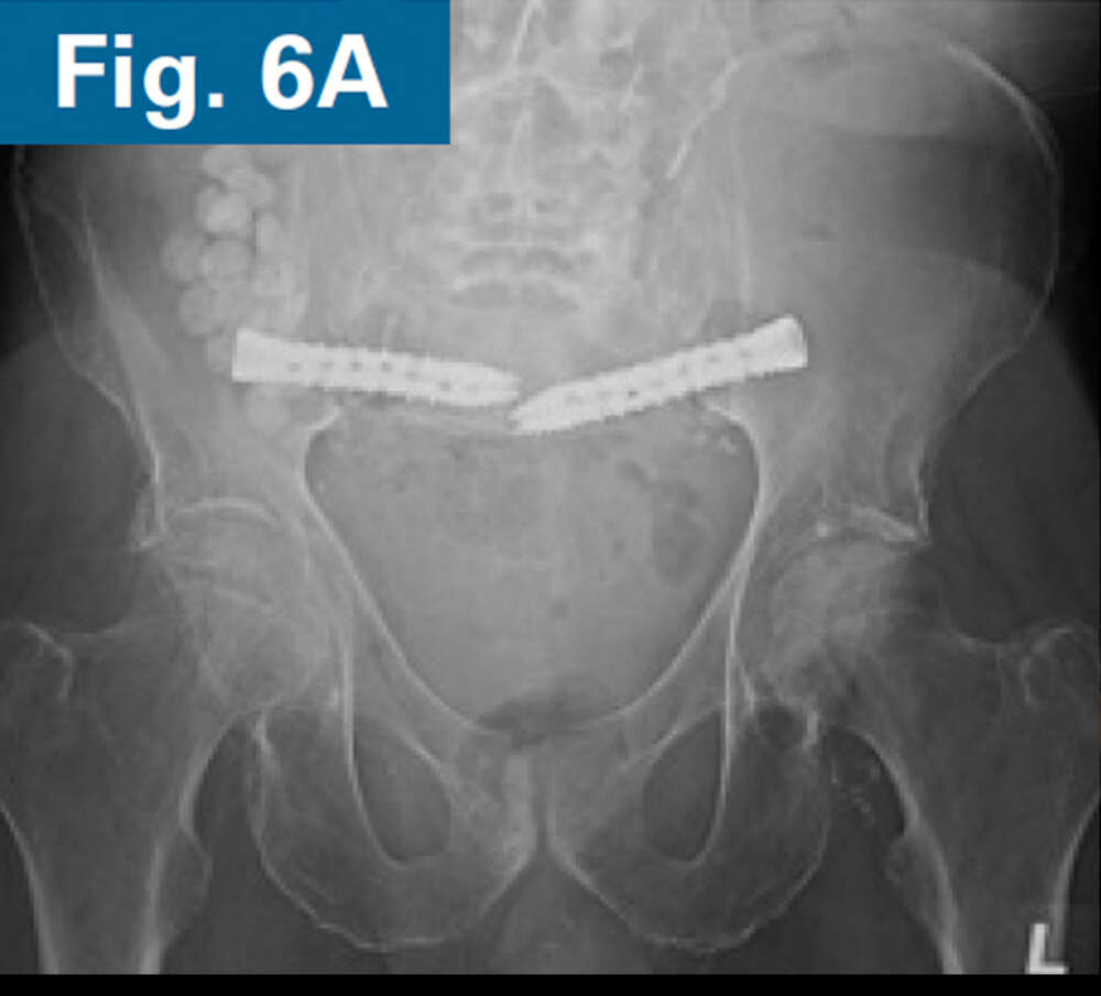 Inline firoozabadi case 2 07