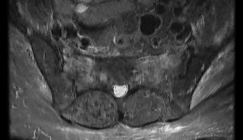 Gardner image 3