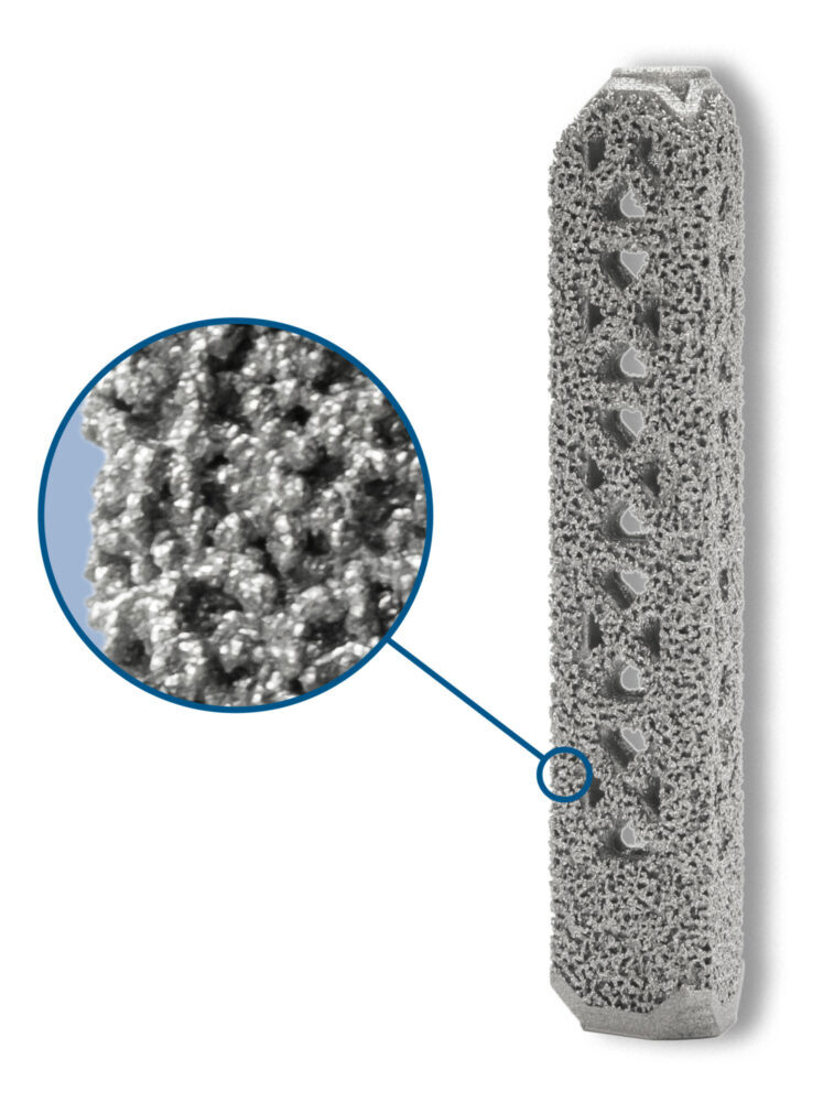 I Fuse 3 D with magnified detail