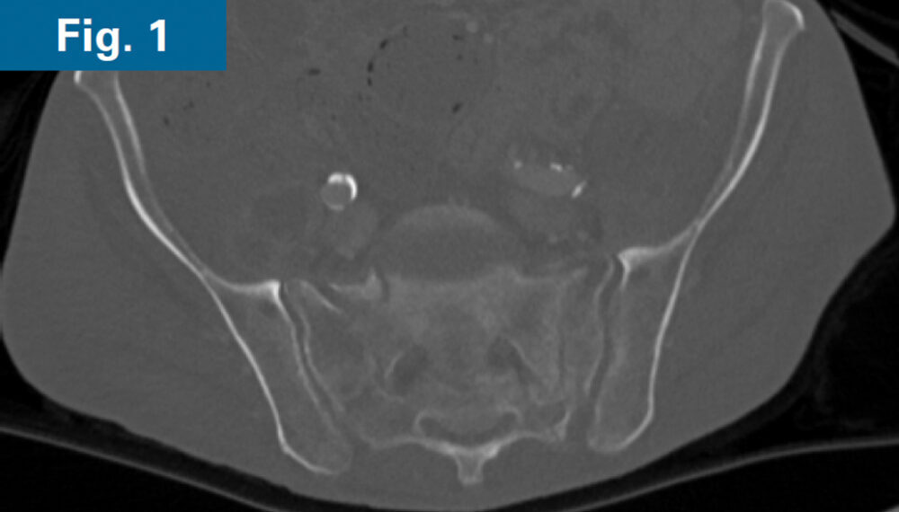 Inline firoozabadi case 2 01