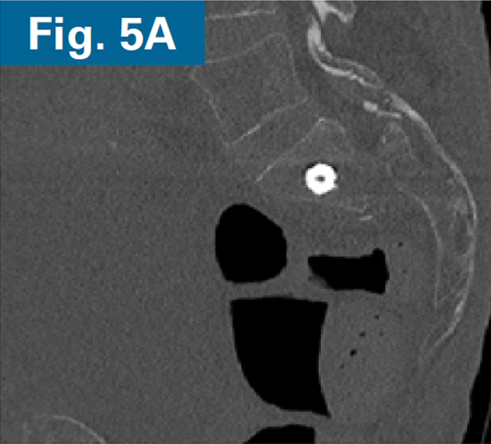 Inline firoozabadi case 2 05