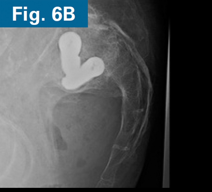 Inline firoozabadi case 2 08