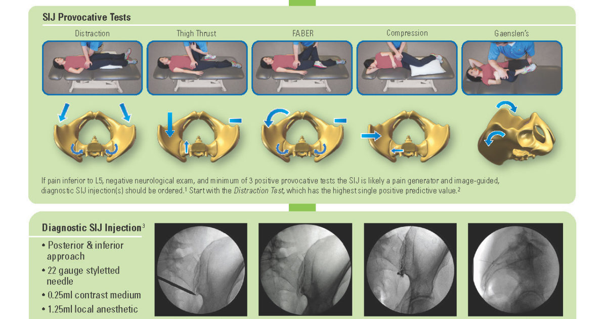 Diagnostic Algorithm for SI Joint Pain SIBONE