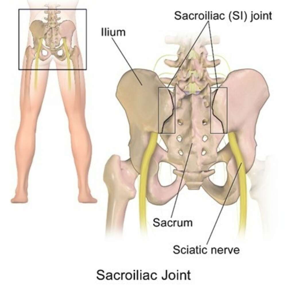 Rehabilitation for the SI Joint | SI-BONE Rehabilitation for the SI Joint | SI-BONE