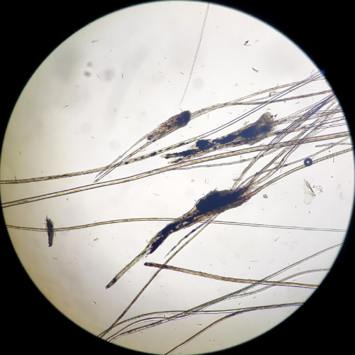 Tricograma con Koh (Colegas)