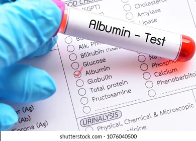 Albumina