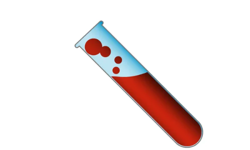 Examen de Sangre  Hans