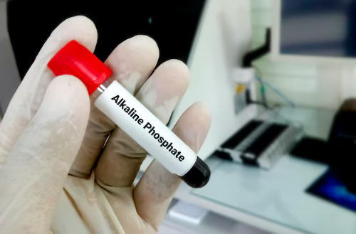 Fosfatasa Alcalina