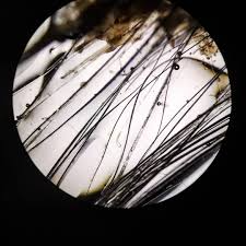 Tricograma colegas