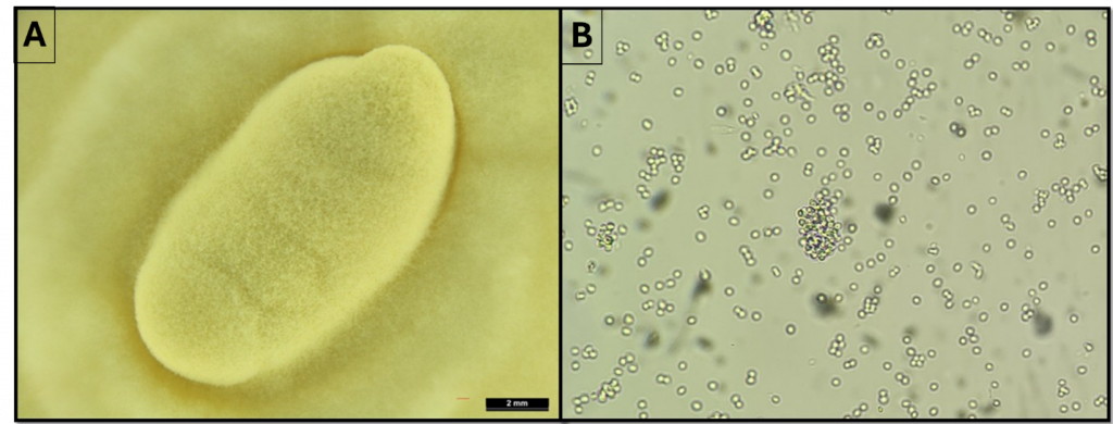 (A) View under a microscope of a yellowish oblong structure, (B) view under a microscope of little spherical dots.