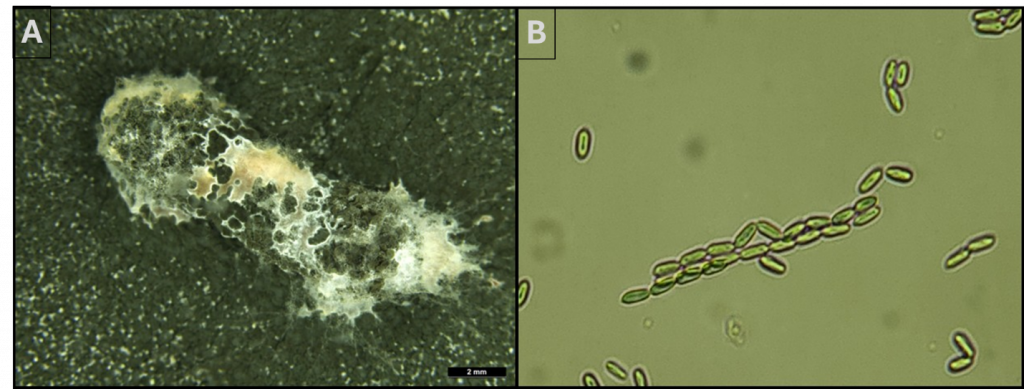 (A) View under a microscope of a roughly peanut-shaped structure mottles with black dots and spotted with white and grey filaments, (B) view under a microscope of little oval dots.