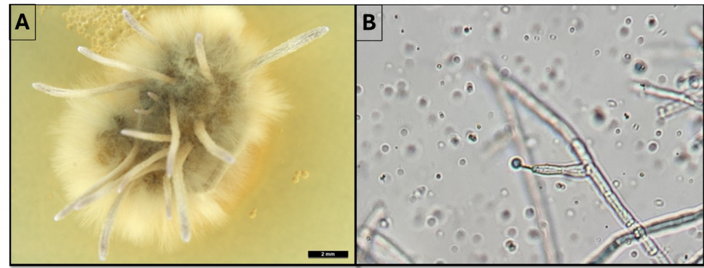 (A) View under a microscope of an oblong structure coated in a halo of golden fuzzy hyphae, with hornlike fruiting bodies protruding from the structure, (B) view under a microscope of filamentous hyphae and spherical spores.