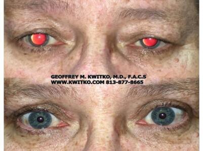 Geoffrey M. Kwitko, MD, FACS.