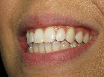 Grant A. Irwin DDS