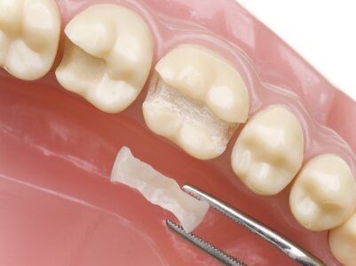 Rohan S. Toor, DDS & David M. Satnick, DMD